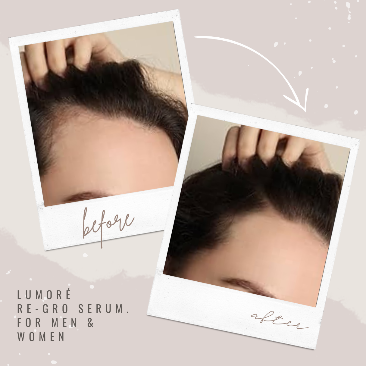 Lumoré Re-Gro Hair Growth Serum For Hair Loss & Thinning