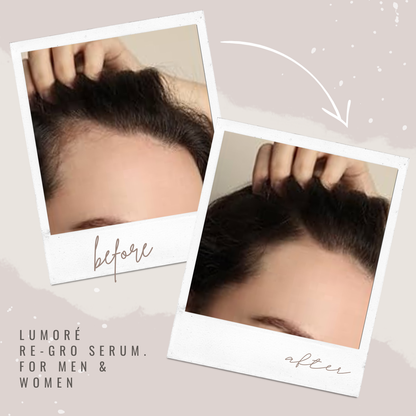 Lumoré Re-Gro Hair Growth Serum For Hair Loss & Thinning